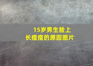 15岁男生脸上长痘痘的原因图片