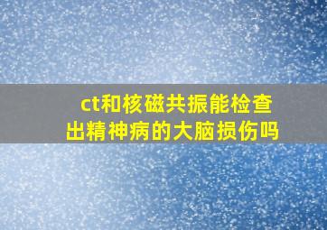 ct和核磁共振能检查出精神病的大脑损伤吗