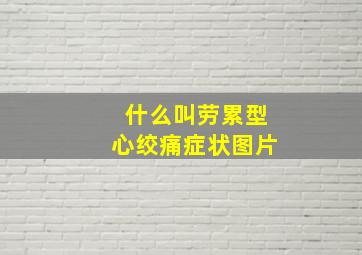 什么叫劳累型心绞痛症状图片