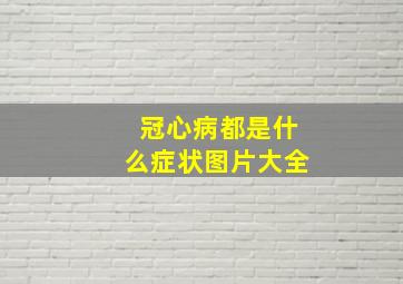 冠心病都是什么症状图片大全