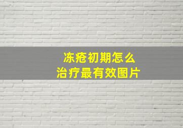 冻疮初期怎么治疗最有效图片