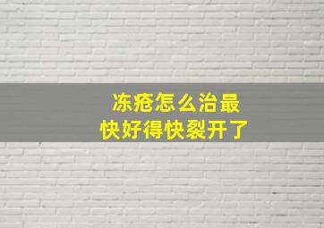 冻疮怎么治最快好得快裂开了