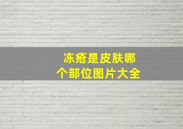 冻疮是皮肤哪个部位图片大全