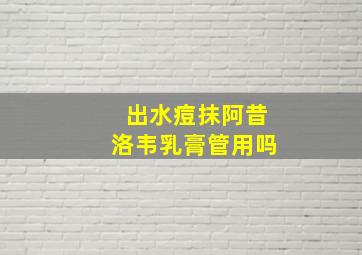 出水痘抹阿昔洛韦乳膏管用吗