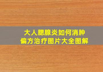 大人腮腺炎如何消肿偏方治疗图片大全图解