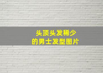 头顶头发稀少的男士发型图片