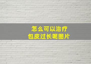 怎么可以治疗包皮过长呢图片