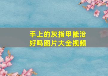 手上的灰指甲能治好吗图片大全视频