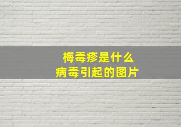 梅毒疹是什么病毒引起的图片