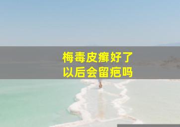 梅毒皮癣好了以后会留疤吗