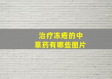 治疗冻疮的中草药有哪些图片