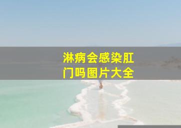 淋病会感染肛门吗图片大全