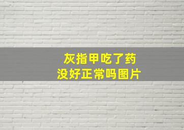 灰指甲吃了药没好正常吗图片