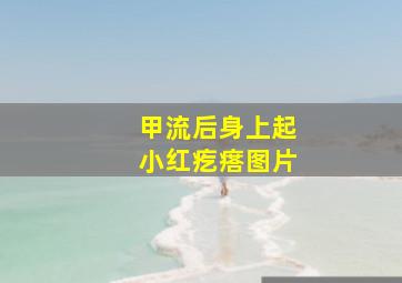 甲流后身上起小红疙瘩图片