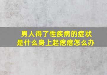 男人得了性疾病的症状是什么身上起疙瘩怎么办