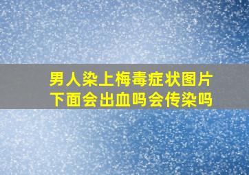 男人染上梅毒症状图片下面会出血吗会传染吗