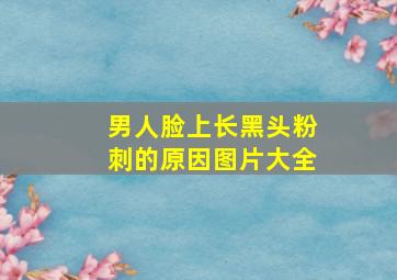 男人脸上长黑头粉刺的原因图片大全