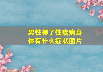 男性得了性疾病身体有什么症状图片