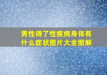 男性得了性疾病身体有什么症状图片大全图解