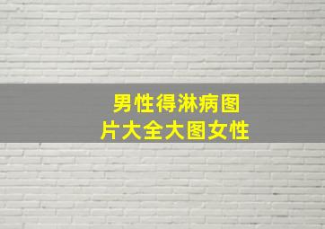 男性得淋病图片大全大图女性