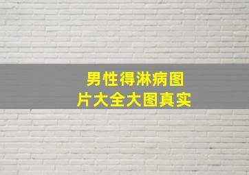 男性得淋病图片大全大图真实