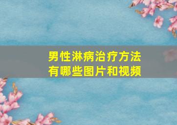 男性淋病治疗方法有哪些图片和视频