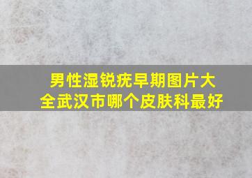 男性湿锐疣早期图片大全武汉市哪个皮肤科最好