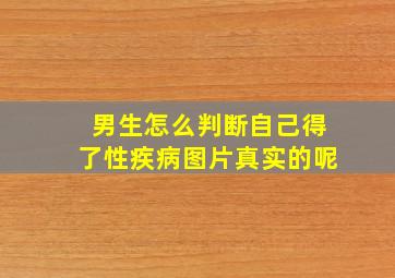 男生怎么判断自己得了性疾病图片真实的呢