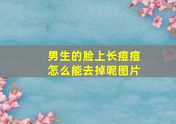 男生的脸上长痘痘怎么能去掉呢图片