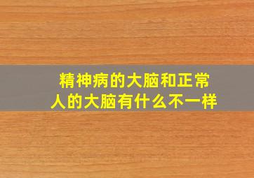 精神病的大脑和正常人的大脑有什么不一样