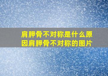 肩胛骨不对称是什么原因肩胛骨不对称的图片