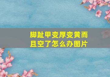 脚趾甲变厚变黄而且空了怎么办图片