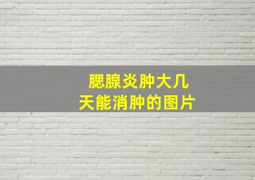 腮腺炎肿大几天能消肿的图片