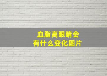 血脂高眼睛会有什么变化图片