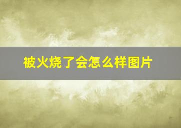 被火烧了会怎么样图片