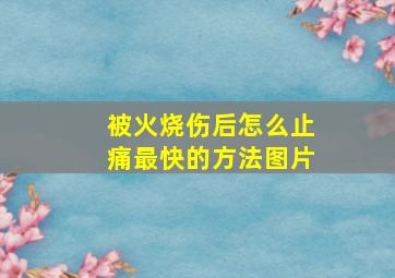 被火烧伤后怎么止痛最快的方法图片