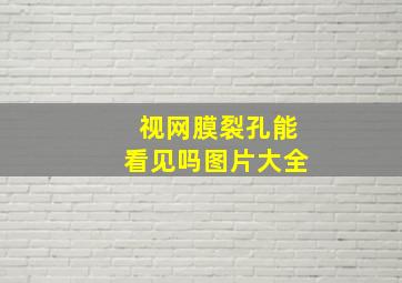 视网膜裂孔能看见吗图片大全