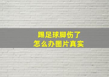 踢足球脚伤了怎么办图片真实