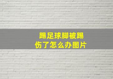 踢足球脚被踢伤了怎么办图片