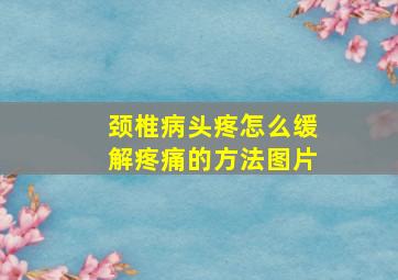 颈椎病头疼怎么缓解疼痛的方法图片